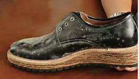 鞋子发霉的因素与鞋子发霉的危害